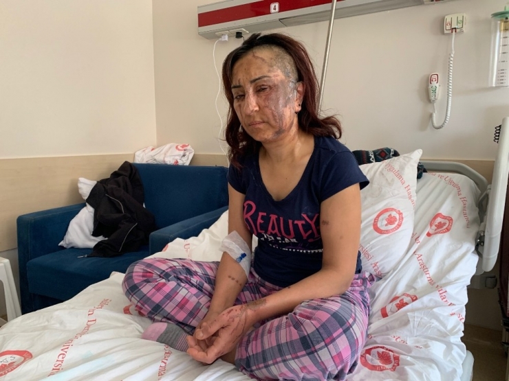 Boşanmak İsteyen Eşine Kezzapla Saldırdı